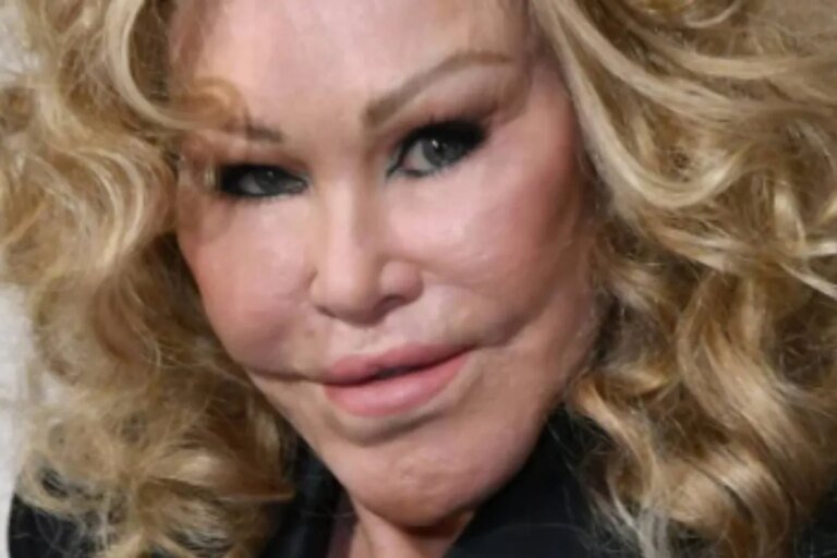 Muere Jocelyn Wildenstein, la millonaria 'Catwoman' que se operó para parecerse a un felino