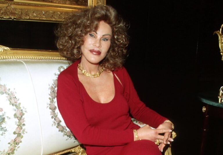 Muere Jocelyn Wildenstein, conocida como ‘Catwoman’, a los 84 años por una embolia pulmonar | Gente