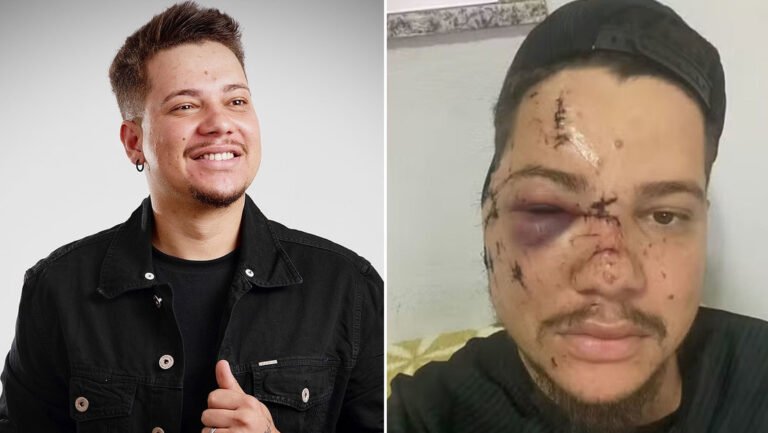 Cantante brasileño recibe 32 puntos en la cara tras ser golpeado con una botella